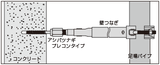 アシバツナギ プレコンタイプ 〈ナット可動式〉施工例